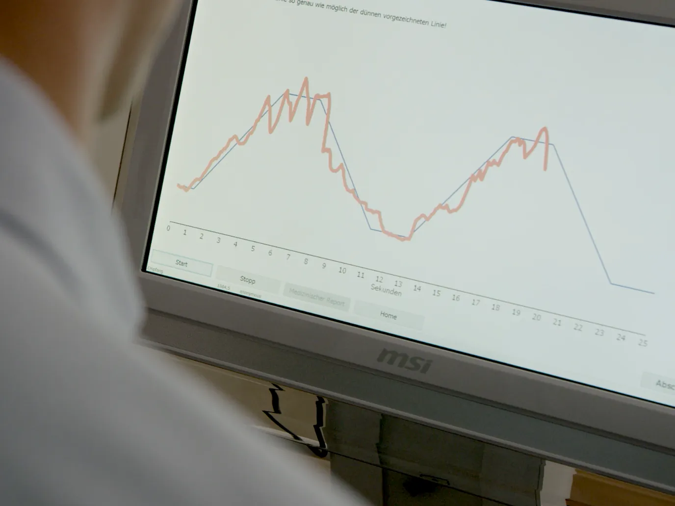 The Bio-Feedback Trainer screen, with a man’s pelvic floor activity traced against the target curve